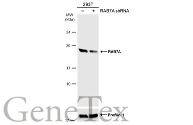 Anti-RAB7A antibody used in Western Blot (WB). GTX132548