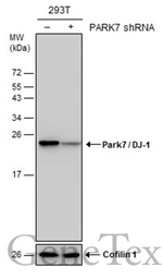 Anti-Park7 / DJ-1 antibody used in Western Blot (WB). GTX132556