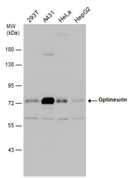 Anti-Optineurin antibody used in Western Blot (WB). GTX132575