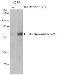 Anti-ULK1 (phospho Ser555) antibody used in Western Blot (WB). GTX132660