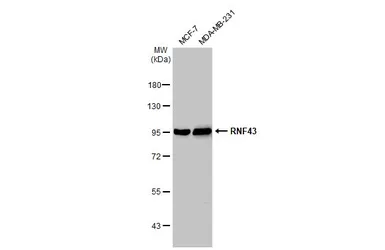 Anti-RNF43 antibody used in Western Blot (WB). GTX132671