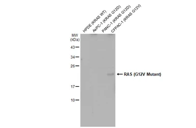 Anti-RAS (G12V Mutant) antibody used in Western Blot (WB). GTX132694