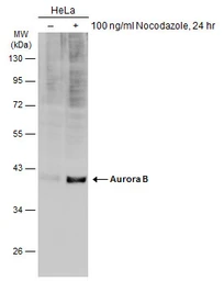 Anti-Aurora B antibody used in Western Blot (WB). GTX132702