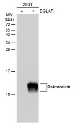Anti-Osteocalcin antibody used in Western Blot (WB). GTX132703