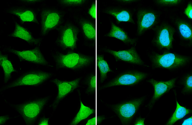 Anti-Nup153 antibody used in Immunocytochemistry/ Immunofluorescence (ICC/IF). GTX132731