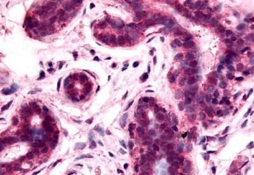 Anti-GPRC5A antibody used in IHC (Paraffin sections) (IHC-P). GTX13274