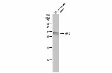 Anti-MPZ antibody used in Western Blot (WB). GTX132747