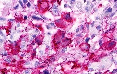 Anti-SREB3 antibody used in IHC (Paraffin sections) (IHC-P). GTX13277