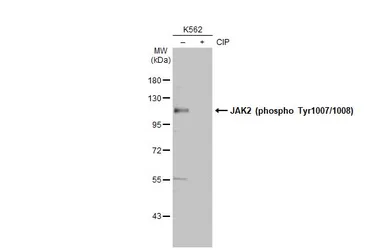 Anti-JAK2 (phospho Tyr1007/1008) antibody used in Western Blot (WB). GTX132784
