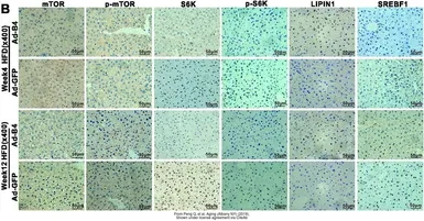 Anti-mTOR (phospho Ser2448) antibody used in IHC (Paraffin sections) (IHC-P). GTX132803