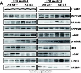 Anti-mTOR (phospho Ser2448) antibody used in Western Blot (WB). GTX132803