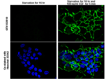 Anti-EGFR (phospho Tyr1068) antibody used in Immunocytochemistry/ Immunofluorescence (ICC/IF). GTX132810