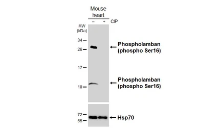 Anti-Phospholamban (phospho Ser16) antibody used in Western Blot (WB). GTX132818
