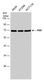 Anti-PKR antibody used in Western Blot (WB). GTX132826