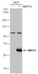 Anti-MMP14 antibody used in Western Blot (WB). GTX132884