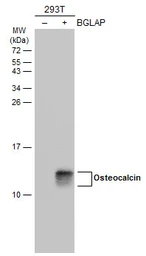 Anti-Osteocalcin antibody used in Western Blot (WB). GTX132902