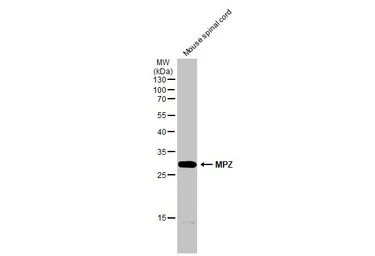 Anti-MPZ antibody used in Western Blot (WB). GTX132954