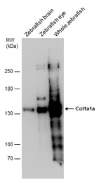 Anti-Col1a1a antibody used in Western Blot (WB). GTX133063