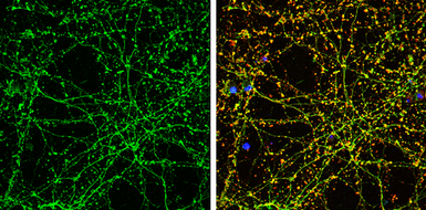 Anti-Serotonin Transporter antibody used in Immunocytochemistry/ Immunofluorescence (ICC/IF). GTX133101