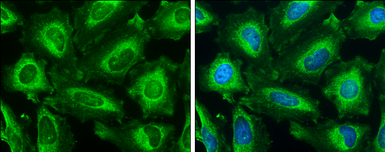Anti-IP3 Receptor I antibody used in Immunocytochemistry/ Immunofluorescence (ICC/IF). GTX133104