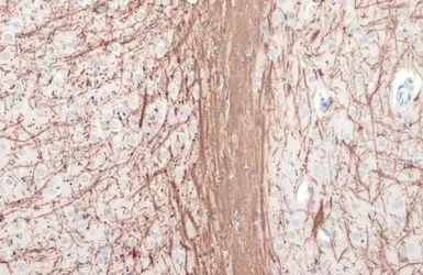 Anti-Myelin basic protein antibody used in IHC (Paraffin sections) (IHC-P). GTX133108