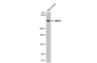 Anti-MAP2 antibody used in Western Blot (WB). GTX133109