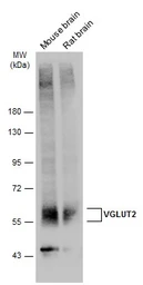 Anti-VGLUT2 antibody used in Western Blot (WB). GTX133142