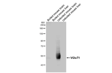 Anti-VGluT1 antibody used in Western Blot (WB). GTX133148