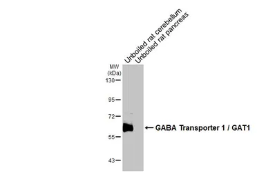 Anti-GABA Transporter 1 / GAT1 antibody used in Western Blot (WB). GTX133150