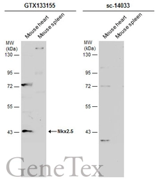 Anti-Nkx2.5 antibody used in Western Blot (WB). GTX133155
