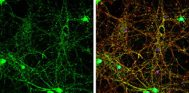 Anti-SHANK3 antibody used in Immunocytochemistry/ Immunofluorescence (ICC/IF). GTX133163