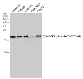 Anti-4E-BP1 (phospho Thr37/Thr46) antibody used in Western Blot (WB). GTX133181