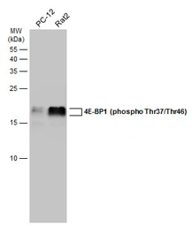 Anti-4E-BP1 (phospho Thr37/Thr46) antibody used in Western Blot (WB). GTX133181