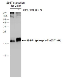 Anti-4E-BP1 (phospho Thr37/Thr46) antibody used in Western Blot (WB). GTX133182