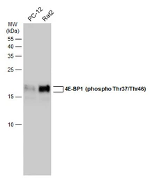 Anti-4E-BP1 (phospho Thr37/Thr46) antibody used in Western Blot (WB). GTX133182