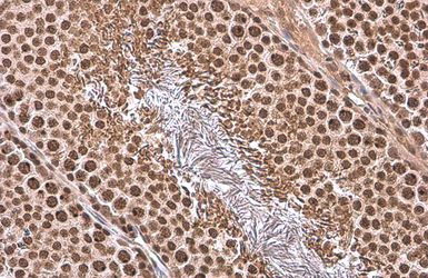 Anti-TBP antibody used in IHC (Paraffin sections) (IHC-P). GTX133204