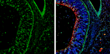 Anti-NeuroD1 antibody used in IHC (Frozen sections) (IHC-Fr). GTX133207