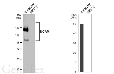 Anti-NCAM antibody used in Western Blot (WB). GTX133217