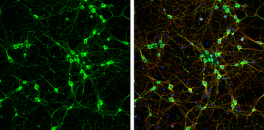 Anti-NF-M antibody used in Immunocytochemistry/ Immunofluorescence (ICC/IF). GTX133218