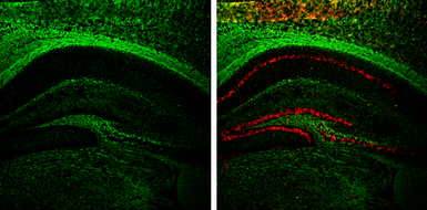 Anti-NF-M antibody used in IHC (Frozen sections) (IHC-Fr). GTX133218