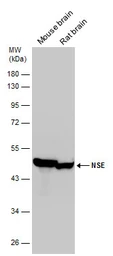 Anti-NSE antibody used in Western Blot (WB). GTX133249