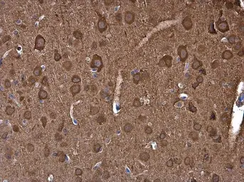 Anti-NSE antibody used in IHC (Paraffin sections) (IHC-P). GTX133249