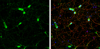 Anti-NSE antibody used in Immunocytochemistry/ Immunofluorescence (ICC/IF). GTX133249