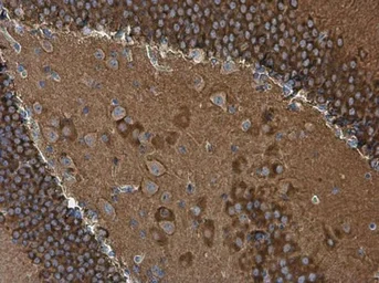 Anti-WAVE1 antibody used in IHC (Paraffin sections) (IHC-P). GTX133263