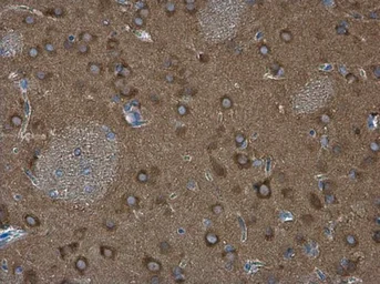 Anti-WAVE1 antibody used in IHC (Paraffin sections) (IHC-P). GTX133263