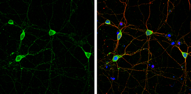 Anti-DLGAP1 antibody used in Immunocytochemistry/ Immunofluorescence (ICC/IF). GTX133264