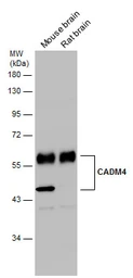 Anti-CADM4 antibody used in Western Blot (WB). GTX133294
