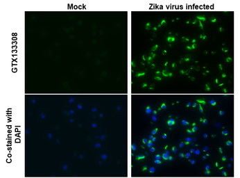 Anti-Zika virus NS2B protein antibody used in IHC-P (cell pellet) (IHC-P (cell pellet)). GTX133308