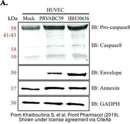 Anti-Zika virus Envelope protein antibody used in Western Blot (WB). GTX133314