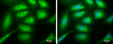 Anti-SH3GL1 antibody used in Immunocytochemistry/ Immunofluorescence (ICC/IF). GTX133333
